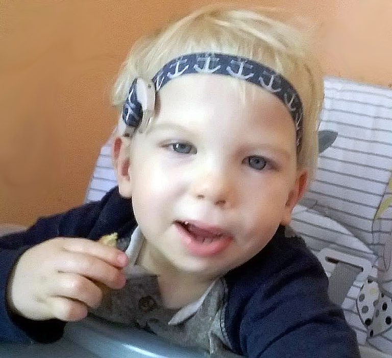 Mateusz chciałby słyszeć głos swojej mamy i umieć mówić… Potrzebuje Twojej pomocy