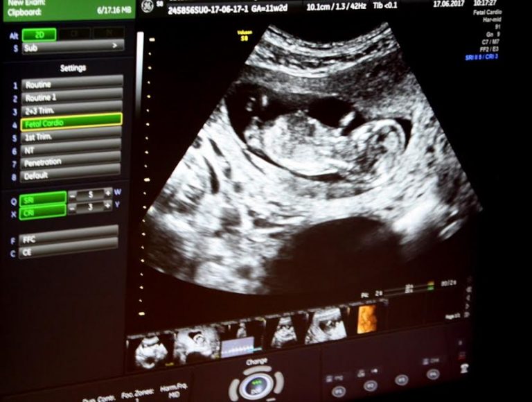 Nowy Sącz – Tuchów: bezpłatne badana prenatalne dla przyszłych mam!