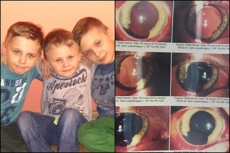 11-letni Rafał został postrzelony. W jego głowie nadal tkwi pocisk. Potrzebna pomoc