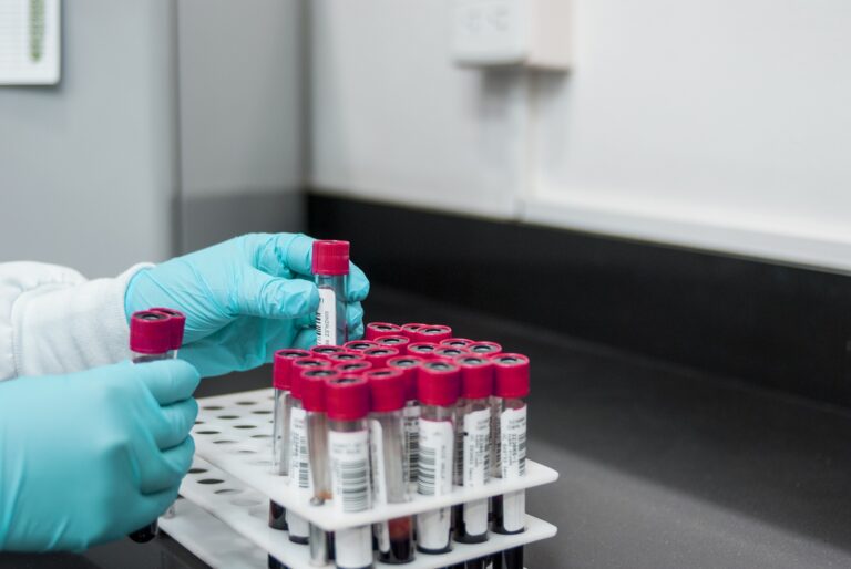 UWAGA! Rusza akcja bezpłatnych testów na przeciwciała w kierunku SARS-CoV-2. Diagmed przebada 300 osób