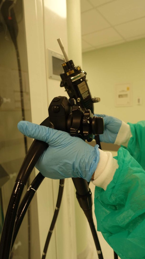 kolonoskopia