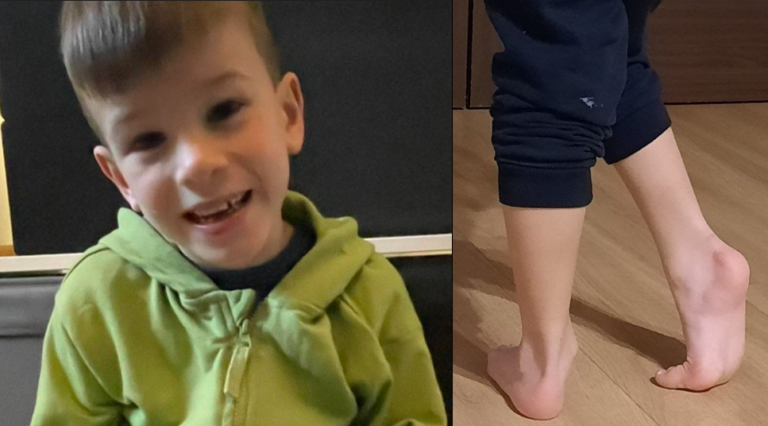 Filip z Nowego Sącza ma 7 lat. Jedynym ratunkiem na pełnię zdrowia jest operacja [ZBIÓRKA]